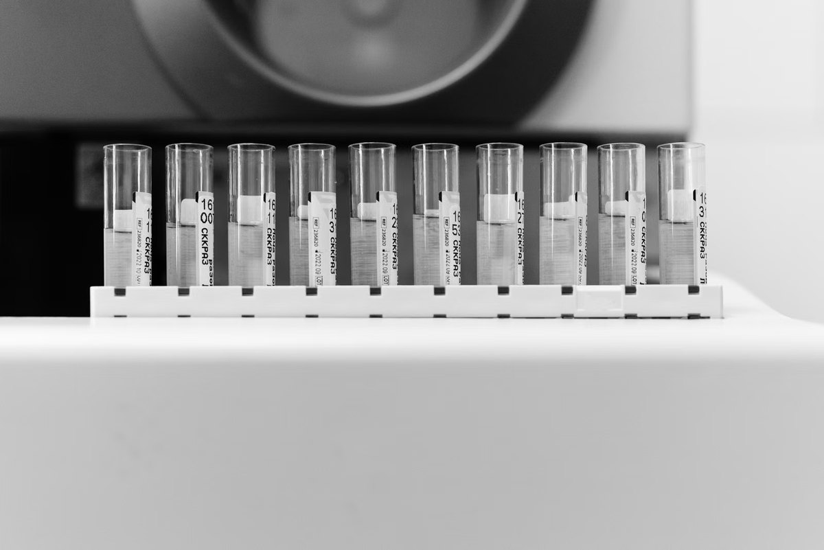 A rack of labelled samples queued for the next round of testing